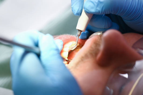 Best Emergency Dental Extractions in Morenci, MI