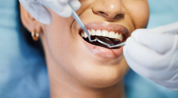 Best Emergency Dentist for Lost Fillings or Crowns in Morenci, MI